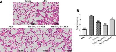 The Alleviation of LPS-Induced Murine Acute Lung Injury by GSH-Mediated PEGylated Artesunate Prodrugs